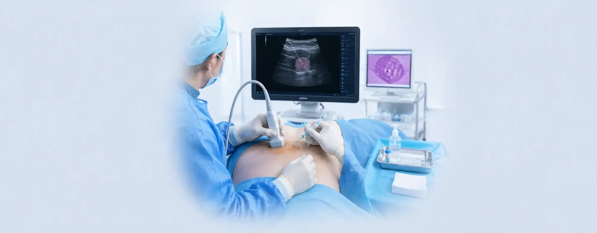 How Image-Guided Biopsies Work: What You Need to Know
