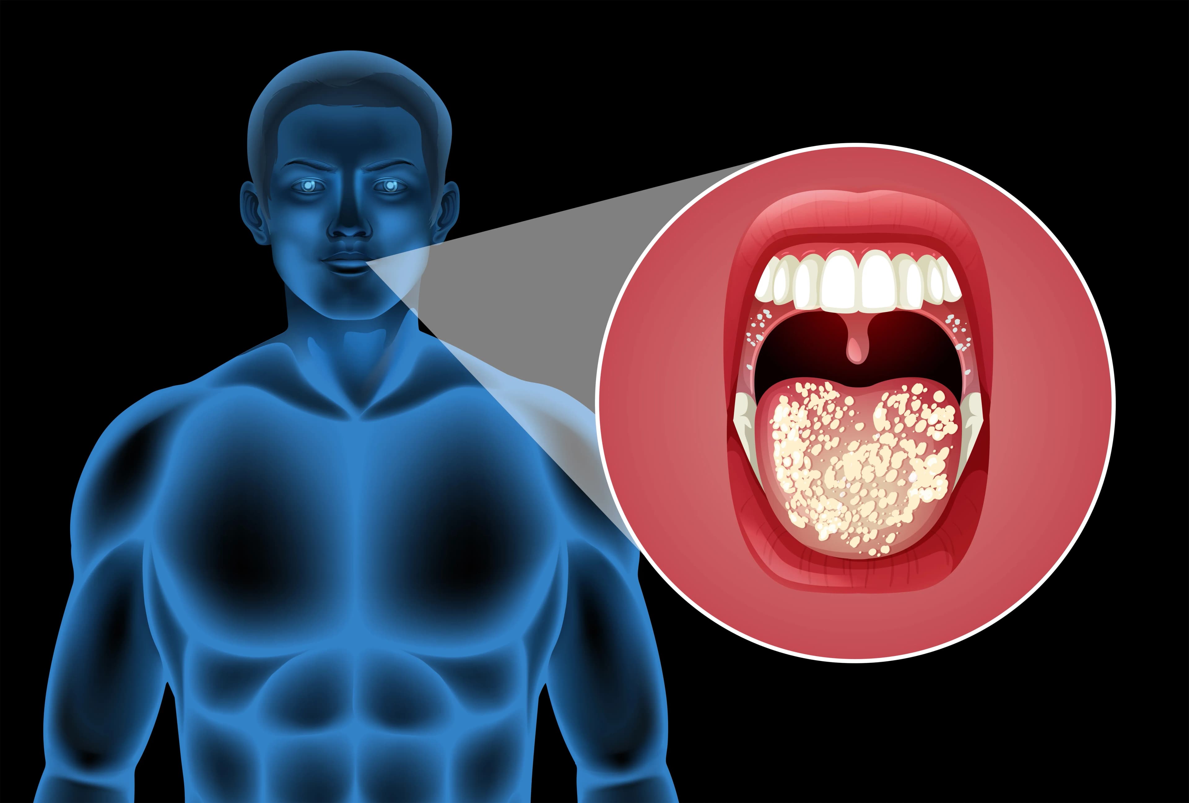 7 Important Signs of Enlarged Adenoids You Need to Know